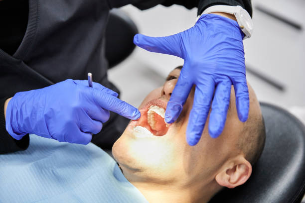 Best Emergency Root Canal Therapy in Cottleville, MO